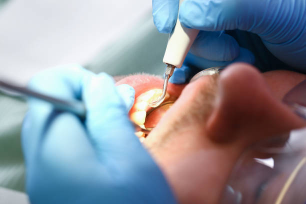 Best Cosmetic Emergency Dentistry in Bloomfield, IN