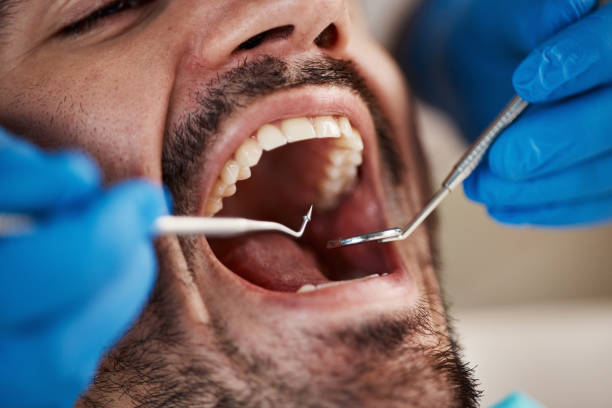 Best Urgent Care for Lost Fillings or Crowns in Bloomfield, IN